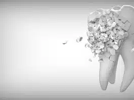 Est-il dangereux de ne pas se faire soigner une dent cassée ?