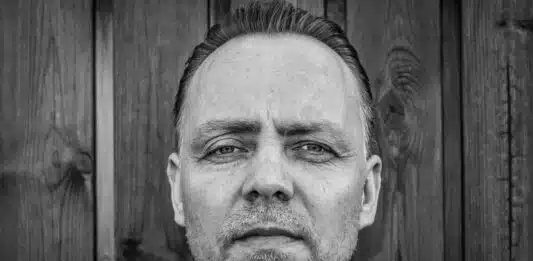 En quoi consiste la greffe de cheveux HST ?